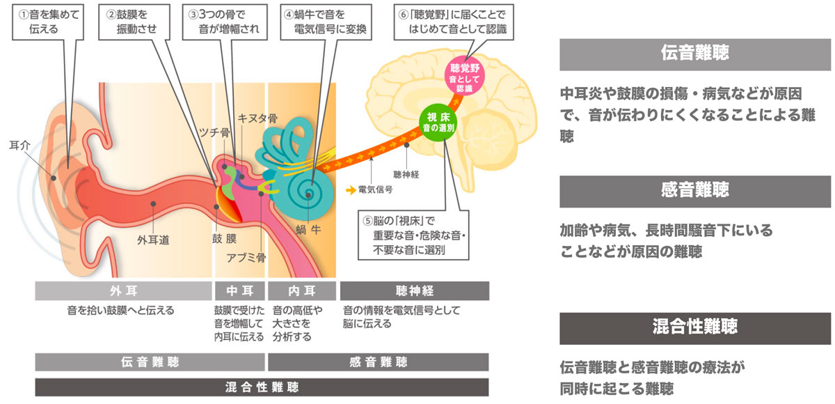 耳の構造と難聴の種類