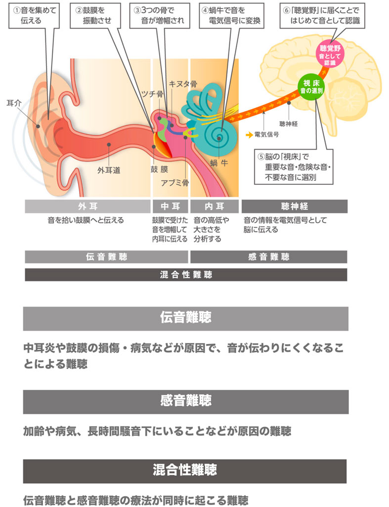 耳の構造と難聴の種類